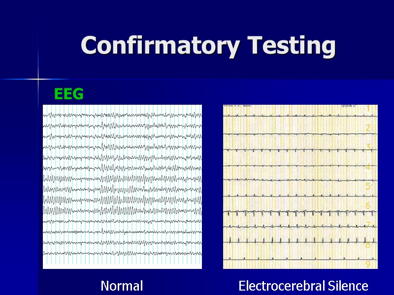 Confirmatory Testing EEG Normal Electrocerebral Silence